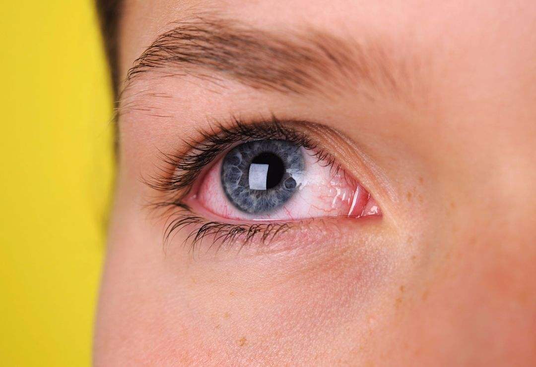 眼睛如若出現三個異常狀況，可能體內有癌症。