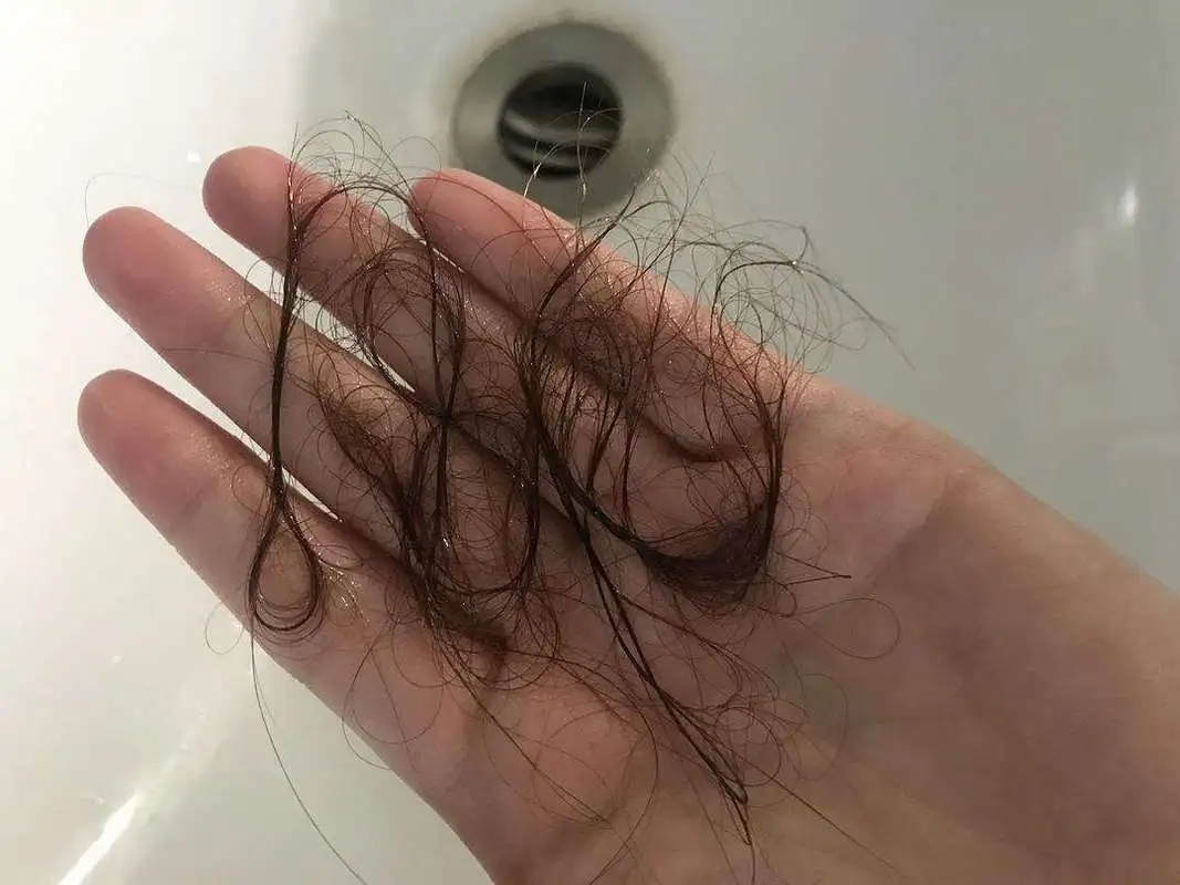 拯救掉髮有機會，解決腎虛促進頭髮生長。