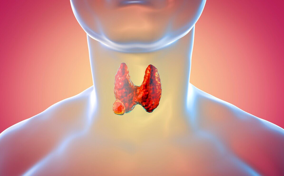 睡覺時若有三種狀況，可能是甲狀腺癌。
