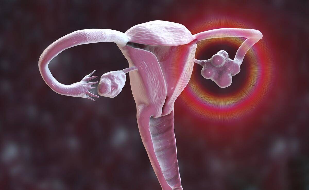先天性無陰道症不會影響女人的生育能力。